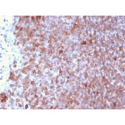 Lymphocyte Specific Protein 1 (LSP1) / pp52(LSP1/3025), CF640R conjugate, 0.1mg/mL