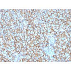 MCAM (Melanoma Cell Adhesion Molecule) / MUC18 / CD146(MCAM/3048), CF640R conjugate, 0.1mg/mL