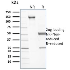 Spectrin beta I (SPTB)(RG/26), CF640R conjugate, 0.1mg/mL