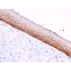 CD44v4/5 (Marker of Tumor Metastasis)(3D2), CF640R conjugate, 0.1mg/mL