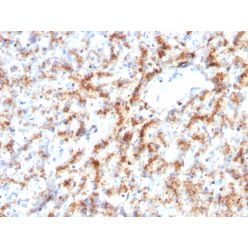 Biotium BNC403082-500, Cathepsin D (Tumor Marker)(CTSD/3082), CF640R conjugate, 0.1mg/mL