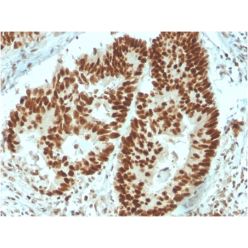 MSH6 (DNA Mismatch Repair Protein)(MSH6/3091), CF640R conjugate, 0.1mg/mL