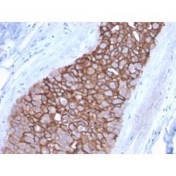HER-2 / c-erbB-2 / neu / CD340(ERBB2/3092), CF640R conjugate, 0.1mg/mL
