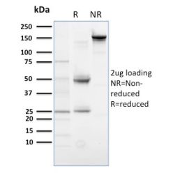 PLK1 (Marker of Mitosis)(AZ44), CF640R conjugate, 0.1mg/mL
