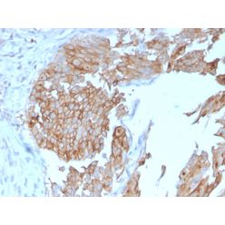 Uroplakin 1B (Urothelial Differentiation Marker)(UPK1B/3102), CF640R conjugate, 0.1mg/mL