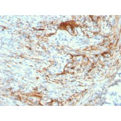 Elastin (ELN) (Marker of Arterial Stiffness and Atherosclerosis)(ELN/3131R), CF640R conjugate, 0.1mg/mL