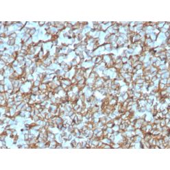 Spectrin beta III (SPTBN2)(SPTBN2/3142R), CF640R conjugate, 0.1mg/mL