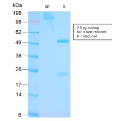 p53 Tumor Suppressor Protein(TP53/3156R), CF640R conjugate, 0.1mg/mL