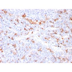 S100A9 + Calprotectin (S100A8/A9 Complex)(MAC3157R), CF640R conjugate, 0.1mg/mL