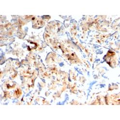 S100A4 / Metastasin / Calvasculin (Marker of Tumor Metastasis)(rS100A4/1481), CF640R conjugate, 0.1mg/mL