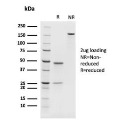 PAX8 (Renal Cell Marker)(rPAX8/1492), CF640R conjugate, 0.1mg/mL