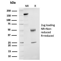 ER-beta-1 (Estrogen Receptor beta-1)(ESR2/3207), CF640R conjugate, 0.1mg/mL