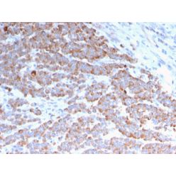 Cytokeratin 18 (KRT18)(rKRT18/1190), CF640R conjugate, 0.1mg/mL