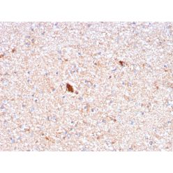 Serum Amyloid P / APCS(APCS/3240), CF640R conjugate, 0.1mg/mL