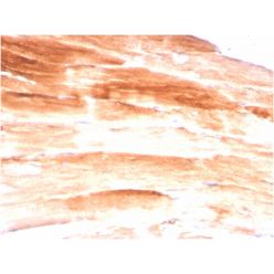 Dystrophin (DMD) (Marker of Duchenne and Becker Muscular Dystrophy)(DMD/3245), CF640R conjugate, 0.1mg/mL