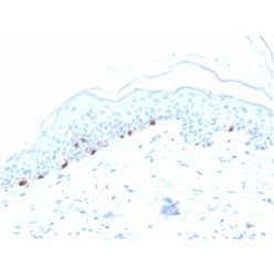Tyrosinase-Related Protein-1 (TYRP-1) (Melanoma Marker)(TYRP1/3280), CF640R conjugate, 0.1mg/mL