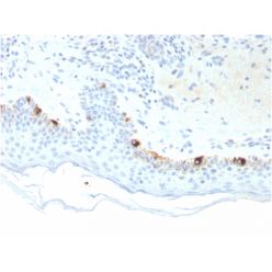 Tyrosinase-Related Protein-1 (TYRP-1) (Melanoma Marker)(TYRP1/3281), CF640R conjugate, 0.1mg/mL