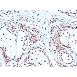 Nucleophosmin (Acute Myeloid Leukemia Marker)(NPM1/3286), CF640R conjugate, 0.1mg/mL