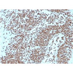 Nucleophosmin (Acute Myeloid Leukemia Marker)(NPM1/3287), CF640R conjugate, 0.1mg/mL