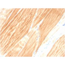 Sarcomeric Actinin Alpha 2 / ACTN2(ACTN2/3295), CF640R conjugate, 0.1mg/mL