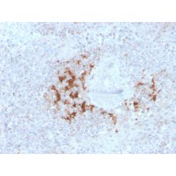 TRAF1 (TNFR-Associated Factor 1) (Lymphomatoid Papulosis Marker)(TRAF1/3298), CF640R conjugate, 0.1mg/mL