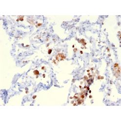 Napsin A (Lung Adenocarcinoma Marker)(NAPSA/3306), CF640R conjugate, 0.1mg/mL