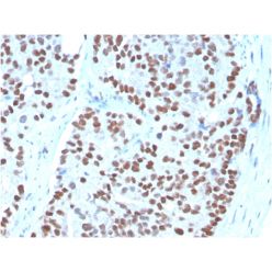 NKX3.1 (Metastatic Prostate Adenocarcinoma Marker)(NKX3.1/3348), CF640R conjugate, 0.1mg/mL
