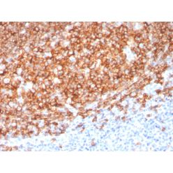Biotium BNC403410-500, CD20 / MS4A1 (B-Cell Marker)(MS4A1/3410), CF640R conjugate, 0.1mg/mL