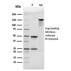 Biotium BNC403450-500, Alpha Actinin 4 / ACTN4(93), CF640R conjugate, 0.1mg/mL