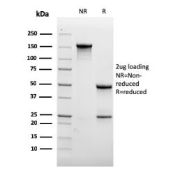 Biotium BNC403462-500, CD31 / PECAM-1 (Endothelial Cell Marker)(rC31.3), CF640R conjugate, 0.1mg/mL