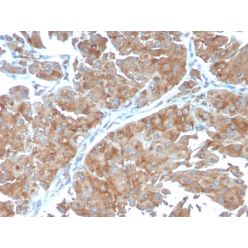 PAI-RBP1 / SERBP1 / SERPINE1(SERBP1/3498), CF640R conjugate, 0.1mg/mL