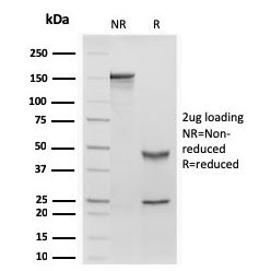 Retinol Binding Protein-1 (RBP1)(rRBP1/872), CF640R conjugate, 0.1mg/mL