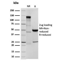 Ornithine Decarboxylase-1 (ODC-1)(ODC1/3636R), CF640R conjugate, 0.1mg/mL