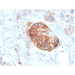 MTAP (Tumor Suppressor Marker)(rMTAP/1813), CF640R conjugate, 0.1mg/mL