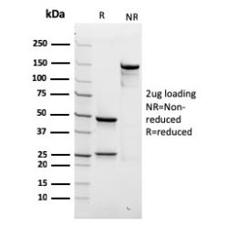 Spectrin beta III (SPTBN2)(rSPTBN2/1778), CF640R conjugate, 0.1mg/mL