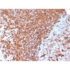 Vimentin (Mesenchymal Cell Marker)(VIM/3736), CF640R conjugate, 0.1mg/mL