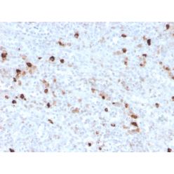Human IgM (Immunoglobulin Mu Heavy Chain) (B-Cell Marker)(IGHM/3776R), CF640R conjugate, 0.1mg/mL
