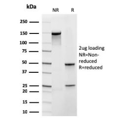 Frataxin (Mitochondrial Marker)(rFXN/2124), CF640R conjugate, 0.1mg/mL