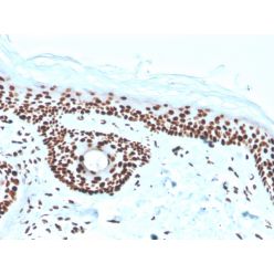 Nucleophosmin (Acute Myeloid Leukemia Marker)(rNPM1/1901), CF640R conjugate, 0.1mg/mL