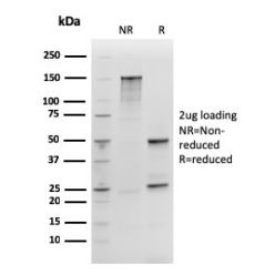 SOX2 (Embryonic Stem Cell Marker)(rSOX2/1792), CF640R conjugate, 0.1mg/mL