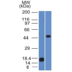 Adipophilin / Perilipin-2 (Marker of Obesity) (ADFP/1365), CF647 conjugate, 0.1mg/mL