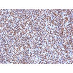 Biotium BNC471504-100, ALK (Anaplastic Lymphoma Kinase) / CD246(ALK/1504), CF647 conjugate, 0.1mg/mL