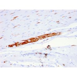 CD56 / NCAM1 / NKH1 (Neuronal Cell Marker)(ERIC-1), CF647 conjugate, 0.1mg/mL