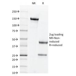 CD44v6 (Marker of Tumor Metastasis)(2F10), CF647 conjugate, 0.1mg/mL