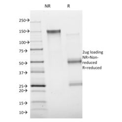 Biotium BNC471672-100, Annexin A1 / (Hairy Cell Leukemia Marker)(ANXA1/1672), CF647 conjugate, 0.1mg/mL
