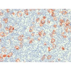 Biotium BNC471919-100, CD30 / TNFRSF8 (Hodgkin & Reed-Sternberg Cell Marker) (rCD30/412), CF647 conjugate, 0.1mg/mL