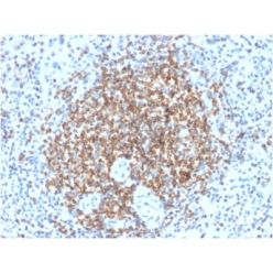 Biotium BNC472210-100, Bcl-2 (Apoptosis & Follicular Lymphoma Marker) (BCL2/2210R), CF647 conjugate, 0.1mg/mL