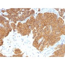 PTH / Parathyroid Hormone (N-Terminal)(3H9), CF555 conjugate, 0.1mg/mL