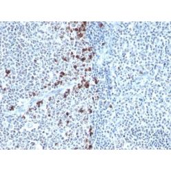 Human Kappa Light Chain(HP6053), CF555 conjugate, 0.1mg/mL