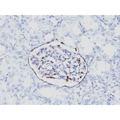 WT1 (Wilm's Tumor 1)(6F-H2), CF555 conjugate, 0.1mg/mL